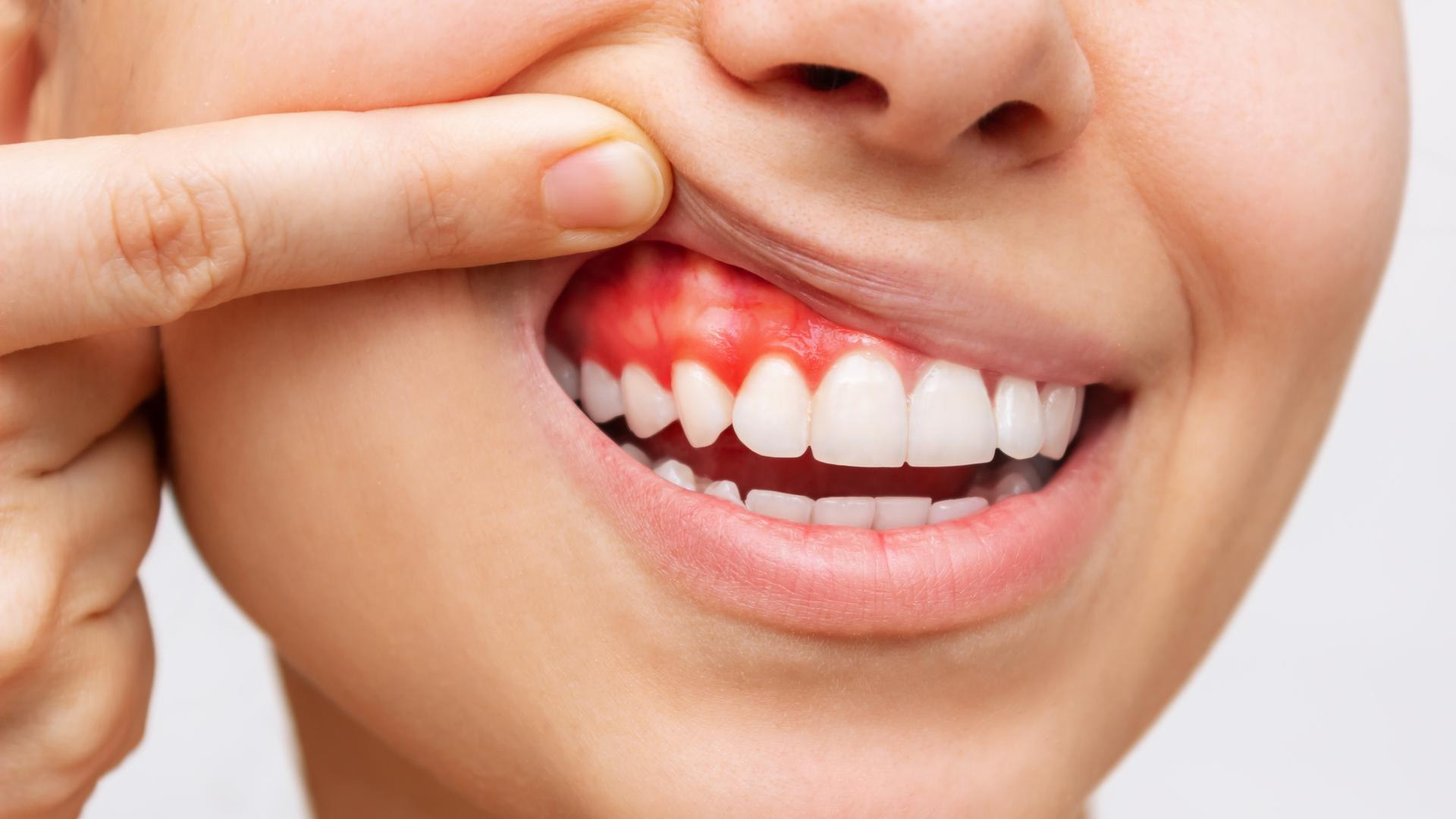 Periodontia